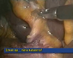 Enkel_operation_risk_for_katastrof.jpeg