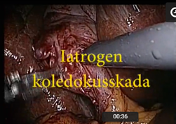 Iatrogen_koledokusskada.jpeg