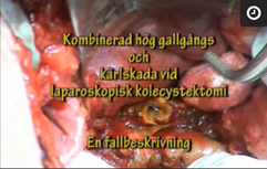 Iatrogen_partiell_resektion_av_d.jpeg